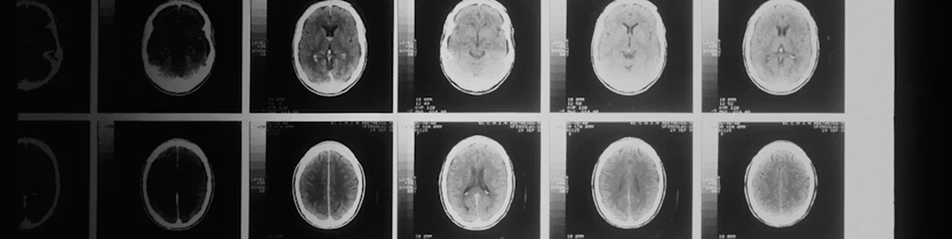 Radiografía del cerebro humano que simboliza la especialización en neurología y la trayectoria médica de la Dra. María Dolores Calabria, neuróloga y divulgadora científica.